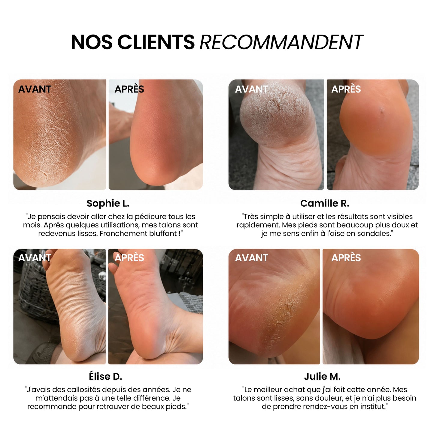 Râpe Électrique pour Pieds